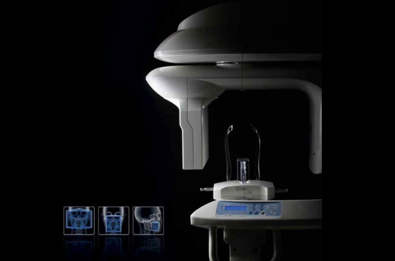 デジタルX線CT撮影装置「Trophypan Pro」